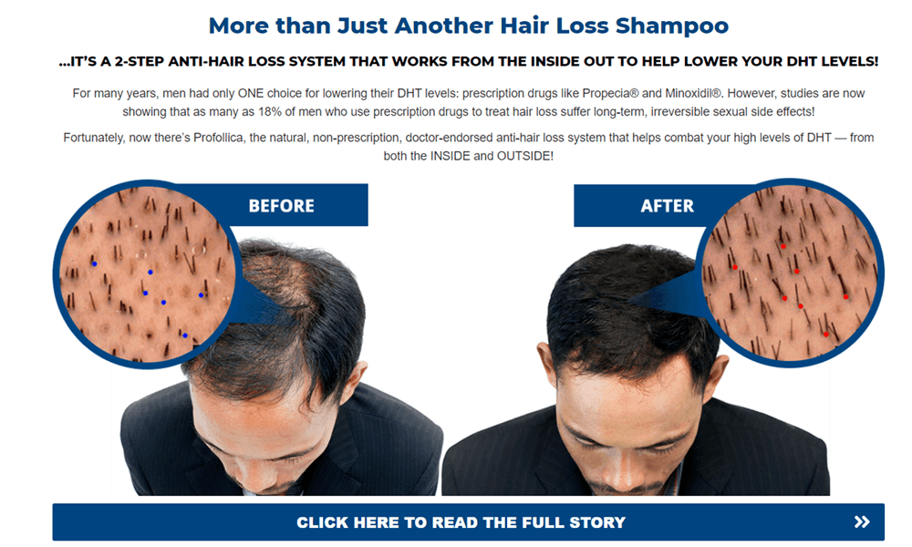 Hair Growth For Male USA Hawaii